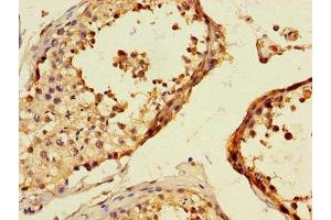 Immunohistochemistry of paraffin-embedded human testis tissue using ABIN7172291 at dilution of 1:100 (TLL1 anticorps  (AA 522-643))