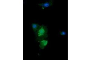 Image no. 3 for anti-ERG, ETS transcription factor (ERG) antibody (ABIN1498077)
