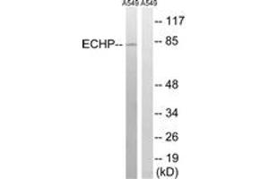 Western blot analysis of extracts from A549 cells, using EHHADH Antibody.