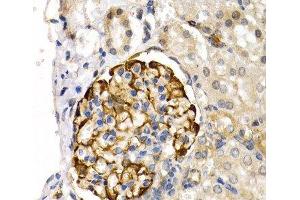 Immunohistochemistry of paraffin-embedded Rat kidney using LIPG Polyclonal Antibody at dilution of 1:200 (40x lens). (LIPG anticorps)