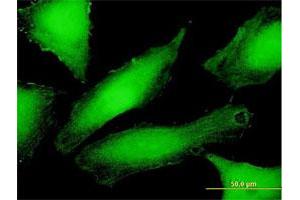 Immunofluorescence of purified MaxPab antibody to PSMD10 on HeLa cell.