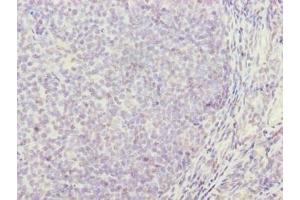 Immunohistochemistry of paraffin-embedded human tonsil tissue using ABIN7171361 at dilution of 1:100 (TRIM anticorps  (AA 29-186))