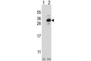 Western blot analysis of CLTB (arrow) using rabbit polyclonal CLTB Antibody . (CLTB anticorps  (Light Chain))