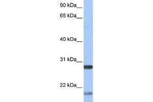 WB Suggested Anti-BDNF Antibody Titration:  0. (BDNF anticorps  (Middle Region))
