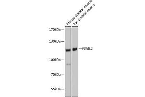 Western blot analysis of extracts of various cell lines, using PIWIL2 antibody (ABIN6132495, ABIN6145700, ABIN6145701 and ABIN6221680) at 1:1000 dilution. (PIWIL2 anticorps)