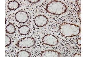 Immunoperoxidase of monoclonal antibody to SP1 on formalin-fixed paraffin-embedded human colon.