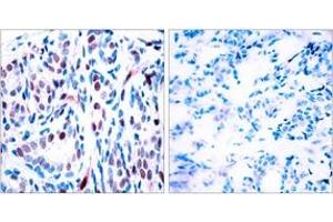 Image no. 1 for anti-Signal Transducer and Activator of Transcription 3 (Acute-Phase Response Factor) (STAT3) (pTyr705) antibody (ABIN2888531) (STAT3 anticorps  (pTyr705))