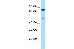 Host: Rabbit Target Name: PTCD1 Sample Type: Jurkat Whole Cell lysates Antibody Dilution: 1. (PTCD1 anticorps  (N-Term))