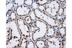 Immunohistochemical staining of paraffin-embedded Kidney tissue using anti-LIPG mouse monoclonal antibody. (LIPG anticorps)