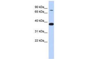 Image no. 1 for anti-Zinc Finger Protein 526 (ZNF526) (AA 179-228) antibody (ABIN6740285) (ZNF526 anticorps  (AA 179-228))