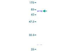 Image no. 1 for Zinc Finger, MYND-Type Containing 10 (ZMYND10) (AA 1-440) protein (GST tag) (ABIN1325843)