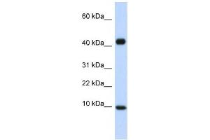 CCL8 antibody (70R-10499) used at 1 ug/ml to detect target protein.
