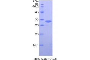 SDS-PAGE analysis of Human PDIA3 Protein. (PDIA3 Protéine)
