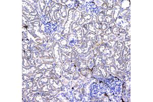 IHC analysis of CD44 using anti-CD44 antibody .