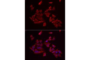 Immunofluorescence analysis of MCF-7 cell using RARRES2 antibody. (Chemerin anticorps)