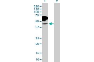 Western Blot analysis of IL2RG expression in transfected 293T cell line by IL2RG MaxPab polyclonal antibody. (IL2RG anticorps  (AA 1-369))