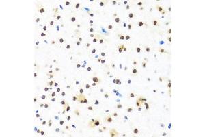 Immunohistochemistry of paraffin-embedded mouse brain using FUBP1 antibody (ABIN6130392, ABIN6140802, ABIN6140804 and ABIN6221231) at dilution of 1:100 (40x lens).