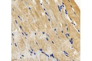 Immunohistochemistry analysis of paraffin-embedded mouse skeletal muscle using SGCA (ABIN7075509) at dilution of 1: 600 (SGCA anticorps)