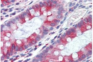 Human Colon (formalin-fixed, paraffin-embedded) stained with TUBB antibody ABIN462130 followed by biotinylated anti-mouse IgG secondary antibody ABIN481714, alkaline phosphatase-streptavidin and chromogen. (TUBB anticorps)