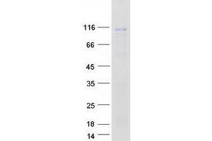 Validation with Western Blot