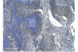 IHC analysis of NRF1 using anti-NRF1 antibody (ABIN7600874).