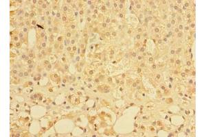 Immunohistochemistry of paraffin-embedded human adrenal gland tissue using ABIN7163662 at dilution of 1:100 (C10orf81 anticorps  (AA 181-462))
