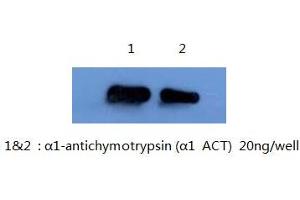 Western Blotting (WB) image for anti-serpin Peptidase Inhibitor, Clade A (Alpha-1 Antiproteinase, Antitrypsin), Member 3 (SERPINA3) antibody (ABIN1105306) (SERPINA3 anticorps)