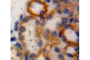 IHC-P analysis of Kidney tissue, with DAB staining. (desert Hedgehog anticorps  (AA 241-383))