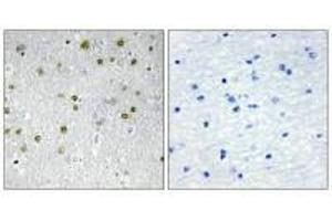 Immunohistochemistry analysis of paraffin-embedded human brain tissue, using NRIP2 antibody. (NRIP2 anticorps  (N-Term))