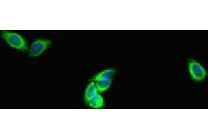 Immunofluorescent analysis of HepG2 cells using ABIN7150861 at dilution of 1:100 and Alexa Fluor 488-congugated AffiniPure Goat Anti-Rabbit IgG(H+L) (DNAH1 anticorps  (AA 2225-2407))