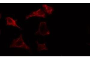 ABIN6275453 staining HuvEc cells by IF/ICC. (IQGAP3 anticorps  (N-Term))