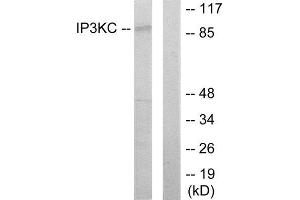 Western Blotting (WB) image for anti-Inositol-Trisphosphate 3-Kinase C (ITPKC) (Internal Region) antibody (ABIN1849902)