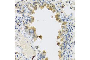 Immunohistochemistry of paraffin-embedded mouse lung using RSPO1 antibody at dilution of 1:100 (40x lens). (RSPO1 anticorps)