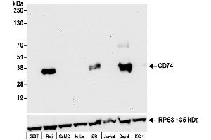 Western Blotting (WB) image for anti-HLA-DR-gamma (CD74) antibody (ABIN7449435)