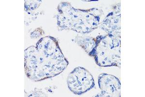 Immunohistochemistry of paraffin-embedded human placenta using KISS1 antibody (ABIN3017121, ABIN3017122, ABIN1680598 and ABIN6219966) at dilution of 1:200 (40x lens). (KISS1 anticorps)