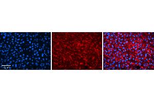 Rabbit Anti-TSPAN31 Antibody   Formalin Fixed Paraffin Embedded Tissue: Human Liver Tissue Observed Staining: Plasma membrane and cytoplasm in hepatocytes Primary Antibody Concentration: N/A Other Working Concentrations: 1:600 Secondary Antibody: Donkey anti-Rabbit-Cy3 Secondary Antibody Concentration: 1:200 Magnification: 20X Exposure Time: 0.