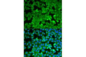 Immunofluorescence (IF) image for anti-Asparagine Synthetase (ASNS) antibody (ABIN1876738) (Asparagine Synthetase anticorps)
