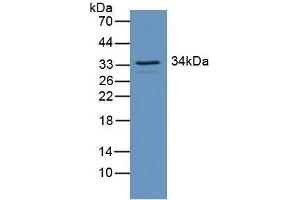 Detection of RGS4 in Mouse Brain Tissue using Polyclonal Antibody to Regulator Of G Protein Signaling 4 (RGS4)