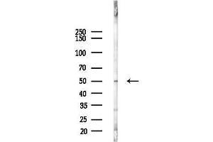 Western blot analysis of lysates from 293 cells(LPS 4h treatment), using Cytochrome P450 3 Antibody at 1/1000 dilution.