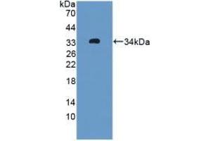 Detection of Recombinant OIT3, Rat using Polyclonal Antibody to Oncoprotein Induced Transcript 3 (OIT3) (OIT3 anticorps  (AA 251-524))