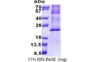 SDS-PAGE (SDS) image for Hairy and Enhancer of Split 2 (HES2) (AA 1-173) protein (His tag) (ABIN5853155)
