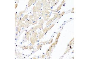 Immunohistochemistry of paraffin-embedded rat heart using YAP1 antibody.