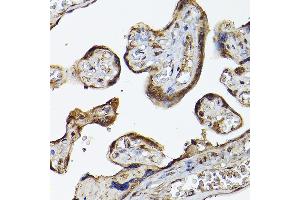 Immunohistochemistry of paraffin-embedded human placenta using PHD3 Rabbit pAb (ABIN6130355, ABIN6139990, ABIN6139991 and ABIN6224021) at dilution of 1:150 (40x lens).