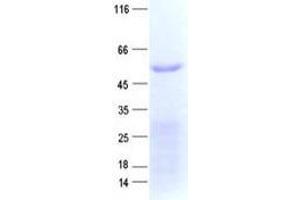 Validation with Western Blot