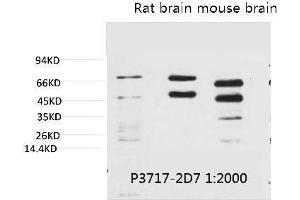 Western blot analysis of 1) Hela, 2) Rat Brain Tissue, 3) Mouse Brain Tissue with Phosphoserine Mouse mAb diluted at 1:2000. (Phosphoserine anticorps)