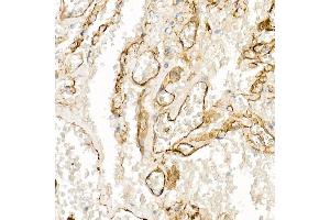 Immunohistochemistry of paraffin-embedded human lung using S100 Rabbit pAb (ABIN3015803, ABIN3015804, ABIN3015805, ABIN1682607 and ABIN6219148) at dilution of 1:100 (40x lens).