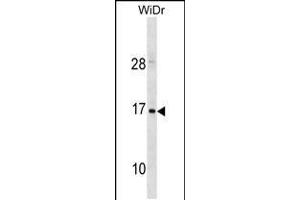 Western blot analysis in WiDr cell line lysates (35ug/lane). (HBZ anticorps  (C-Term))