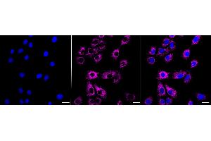 Immunocytochemical staining of HeLa cells with Acyl-CoA dehydrogenase short chain antibody (ABIN7797493), 1:1,000). (Recombinant Acyl Co-A Dehydrogenase (AIDB) (chain short) anticorps)