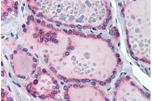 Human Thyroid (formalin-fixed, paraffin-embedded) stained with TRHR antibody ABIN290227 at 10 ug/ml followed by biotinylated goat anti-rabbit IgG secondary antibody ABIN481713, alkaline phosphatase-streptavidin and chromogen. (TRHR anticorps  (AA 350-400))