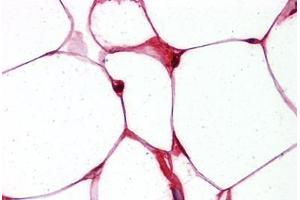 Adipocytes, Human: Formalin-Fixed, Paraffin-Embedded (FFPE) (FABP4 anticorps  (Tyr20))